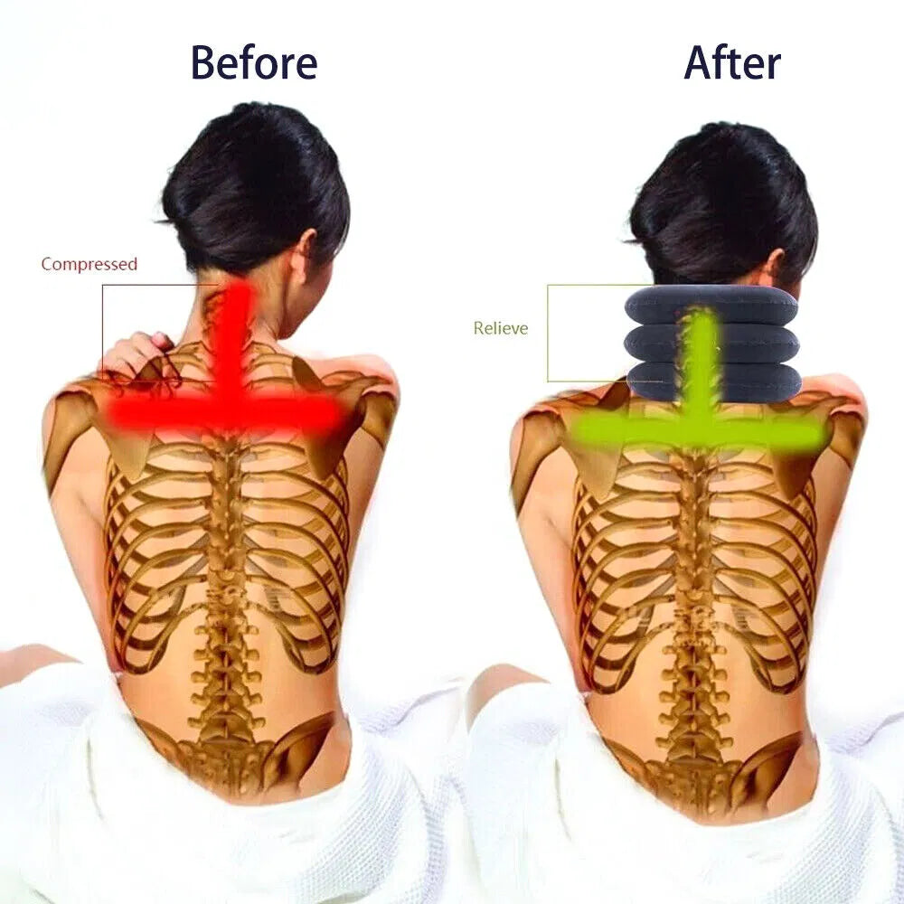 Collar de Tracción Cervical para Alivio del Dolor de Cuello y Terapia